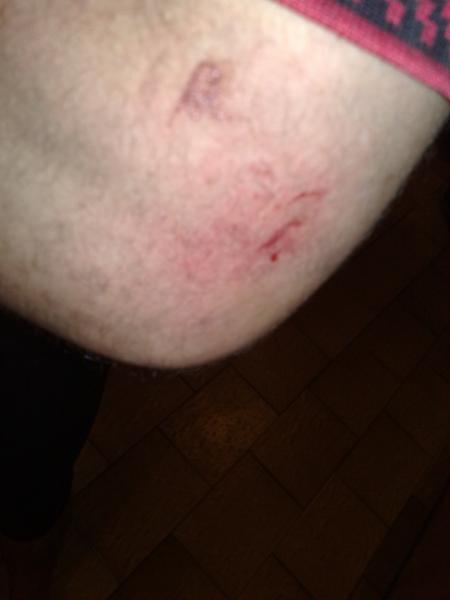 Elbow